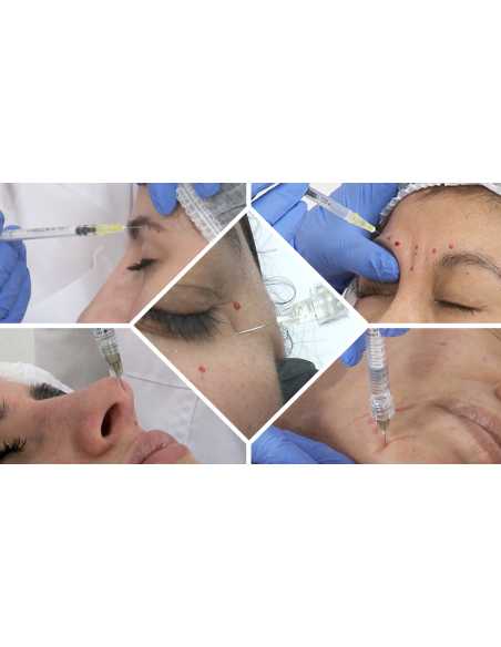 Especialización en Medicina Estética Facial